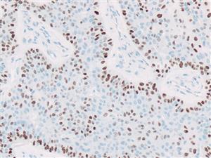 3635A | Control Slides:Immunopathology; p40